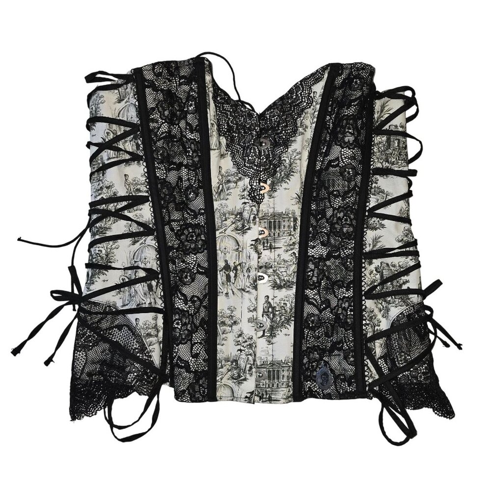 Elegant Black and White Lace Corset